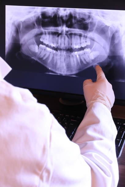 Best Broken Tooth Emergency  in Santa Paula, CA