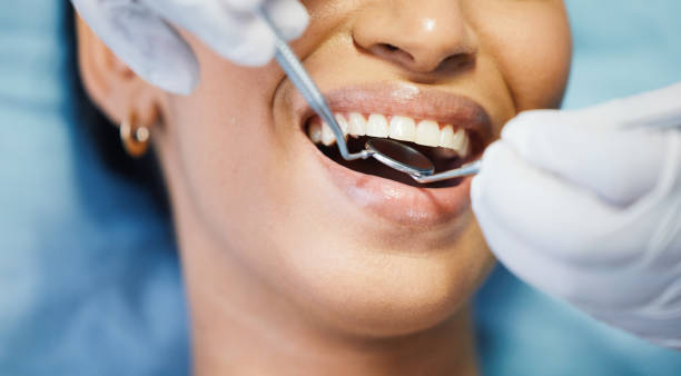 Best Knocked-Out Tooth Emergency  in Santa Paula, CA